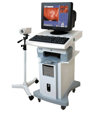 Electronic Colposcope - Click Image to Close