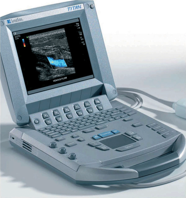 Mobile/portable ultrasound
