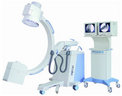 HF Mobile C-arm System HF Mobile C-arm System