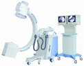 HF Mobile C-arm System HF Mobile C-arm System