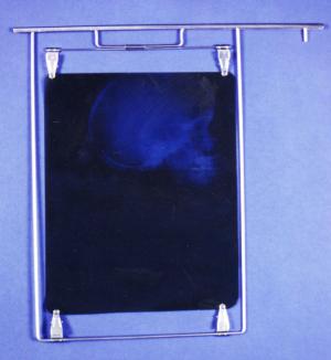 X-ray Film Developing Hangers