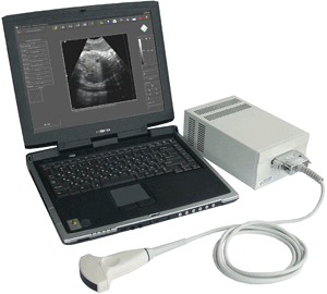 Ultrasound probe interface