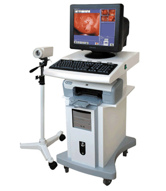 Electronic Colposcope