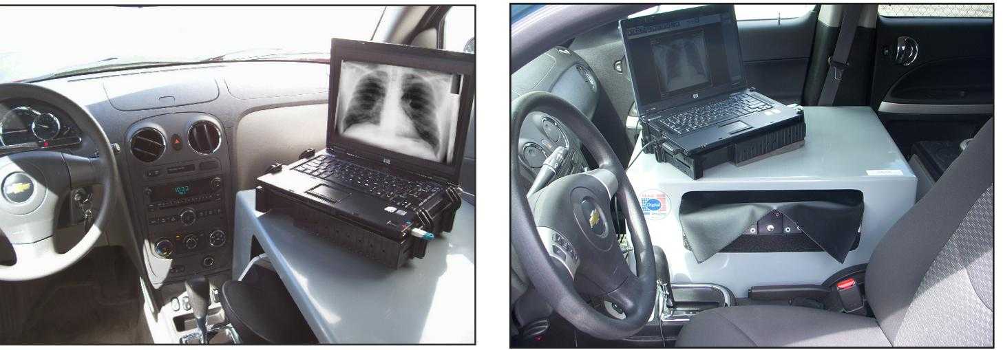 Portable and mobile CR scanner Installation to vehicle