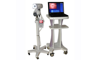 Electronic Colposcope